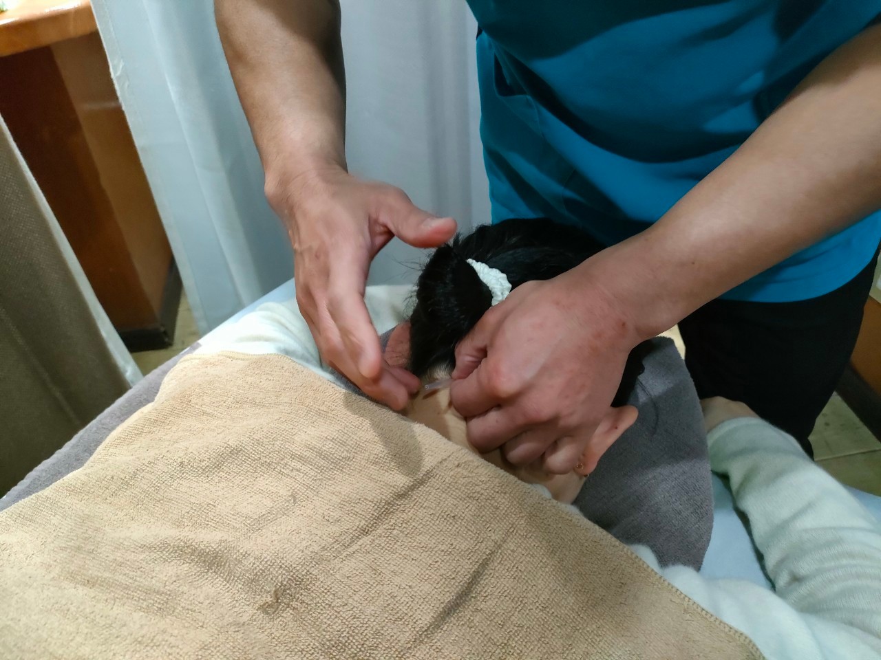 頭痛施術の様子
